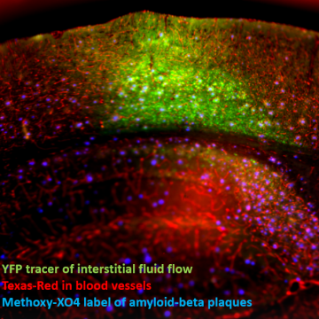 YFP tracer of interstitial fluid flow, Texas-red in blood vessels, and Methoxy-XO4 label of amyloid beta plaques